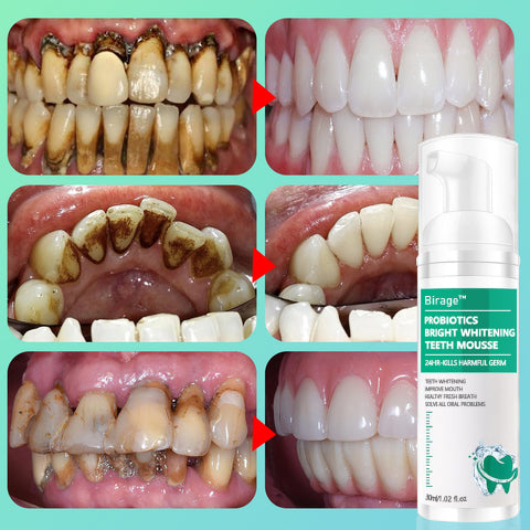 ✨🦷(Vente du dernier jour - 80 % de réduction)Birage™ Herbal Brightening Oral Repair Mousse -Résoudre tous les problèmes bucco-dentaires